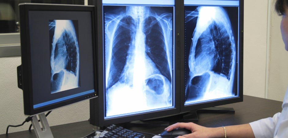 importance of radiology department in hospital